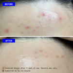 Wholesale - Oat Milk PHA Serum - EqualRXN