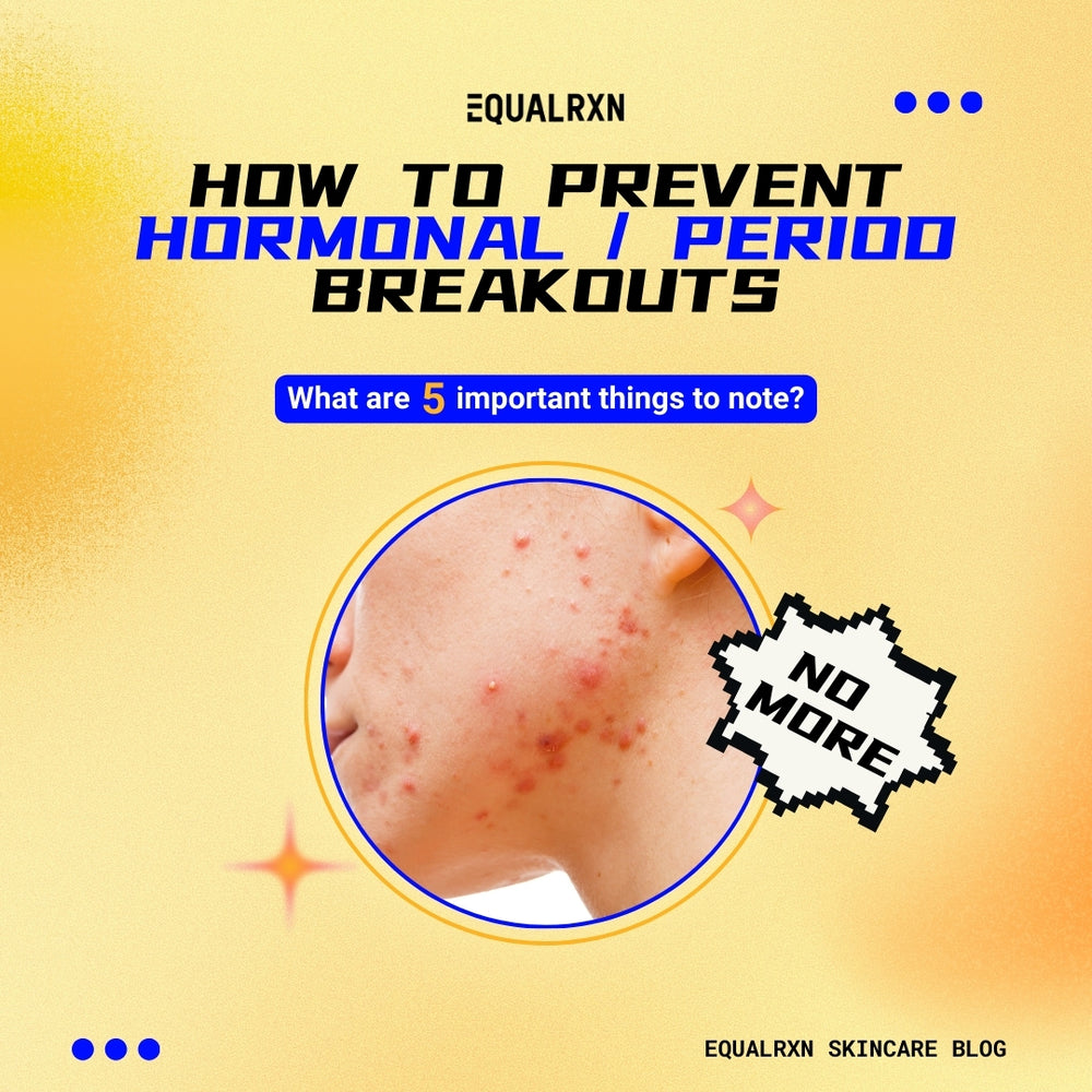 5 Proven Tips to Prevent Hormonal / Period Breakouts