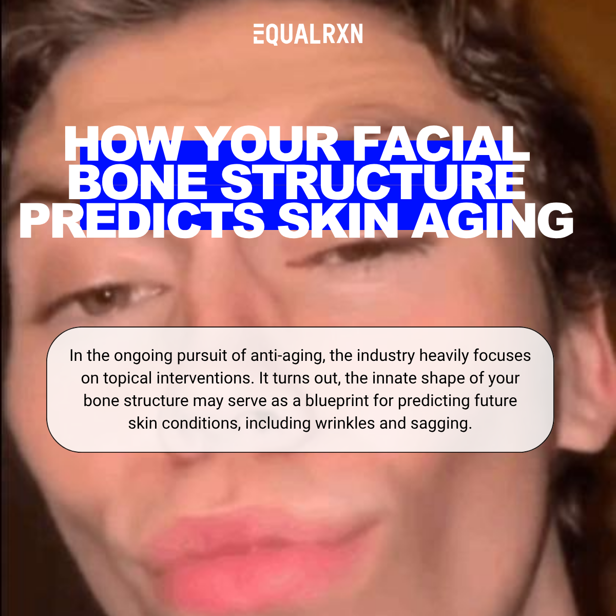 The Anatomy of a Wrinkle: Why Your Bone Structure Dictates Your Skincare Strategy