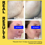 Turmeric Hesperidin Fading Serum - EqualRXN