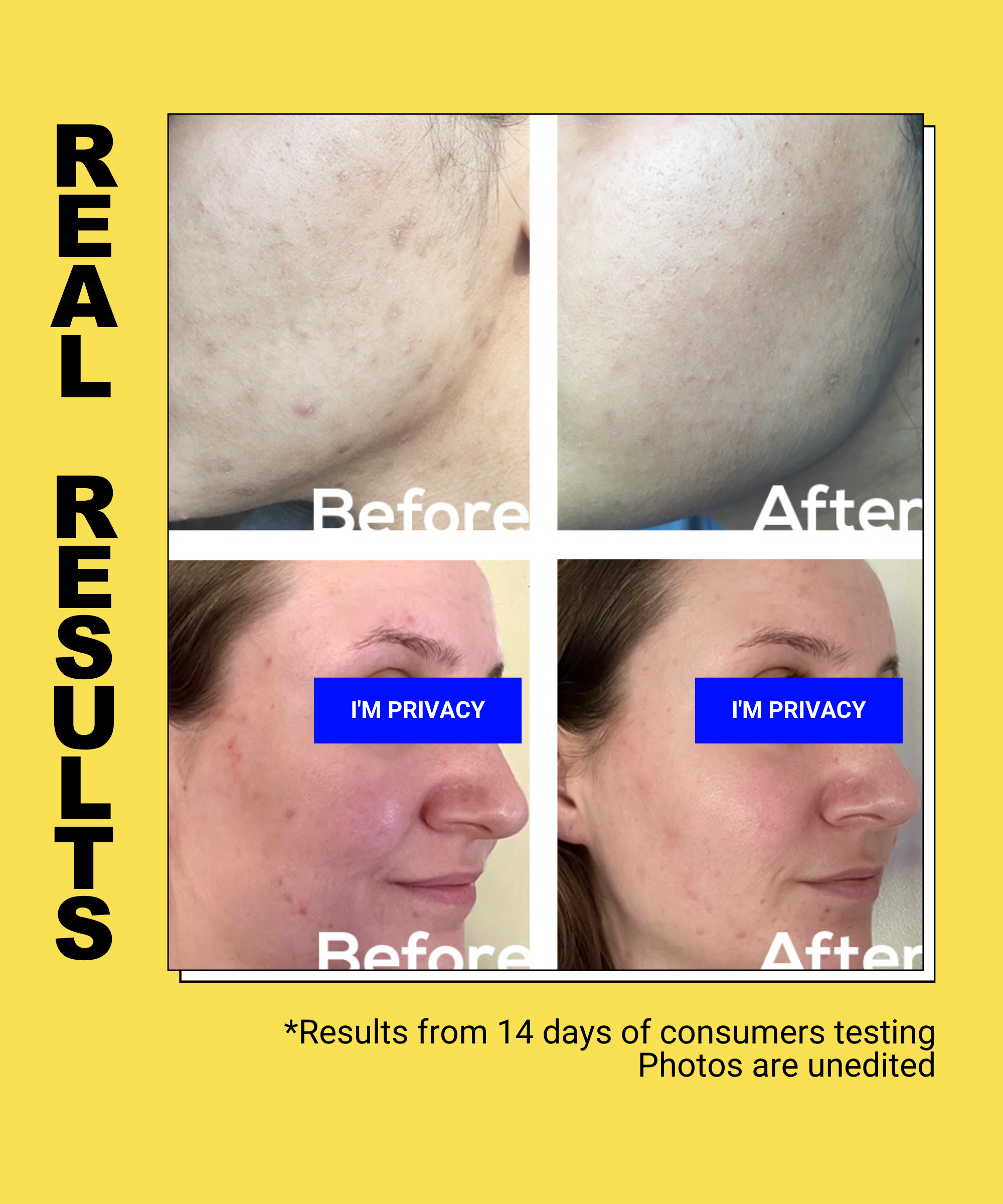 Turmeric Hesperidin Fading Serum - EqualRXN