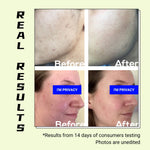 Turmeric Hesperidin Fading Serum - EqualRXN