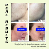 Turmeric Hesperidin Fading Serum - EqualRXN